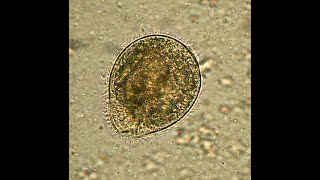 Parasitologia  BALANTIDIASIS  010424 [upl. by Aliam]