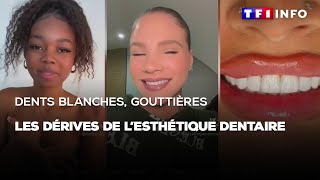 Dents blanches gouttières  les dérives de lesthétique dentaire [upl. by Martica]