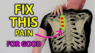 Fix Rhomboid Pain For Good Shoulder Blade Pain [upl. by Levey]