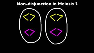 424 Explain that nondisjunction can lead to changes in chromosome number [upl. by Neillij]