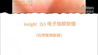 Intubation Practice By Insighters Video Laryngoscope contact yanyuejiaoinsighterscn [upl. by Eener164]