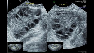 Ultrasound Spotters  Quiz  3 [upl. by Cerys]