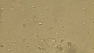 Giardia Trophozoite Looped [upl. by Canon]