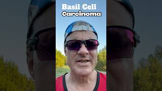 What I Learned From Skin Cancer basalcellcarcinoma [upl. by Anekam854]