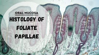 Specialized Mucosa  Histology of Foliate papillae [upl. by Ttenyl]