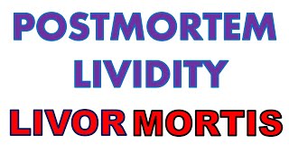 Postmortem Lividity  Livor Mortis  Forensic Medicine  Dr Krup Vasavda [upl. by Ennaxxor]