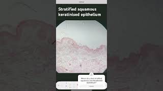 Stratified Squamous Keratinised Epithelium [upl. by Adnohsad226]