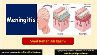 Meningitis  Neurology  Pediatric Review  KML [upl. by Divd]