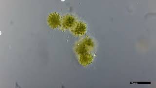 MICROCYSTIS CIANOBACTERIA [upl. by Pass]