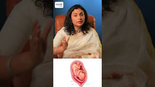 Low Lying Placenta இருந்தா பயப்பட வேண்டிய அவசியம் என்ன  DrPriya Kalyani [upl. by Yerkovich]