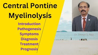 Central Pontine Myelinolysis [upl. by Silera]