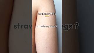 Strawberry legs treatment 😍❤✨aesthetic trending views viralvideos beauty fyp pop song music [upl. by Sheepshanks611]