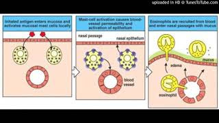 Nasal hyperreactivity and inflammation [upl. by Layap971]