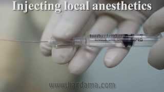 Spinal anesthesia [upl. by Namijneb]