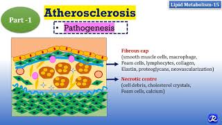 15 Atherosclerosis Part1PathogenesisMajor events Lipid Metabolism15  Biochemistry [upl. by Nairod112]