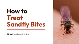 How to Treat Sandfly Bites Effectively Discover the Proven Method [upl. by Beckett127]