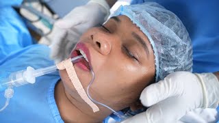 Young Women Slowly losing Consciousness under General Anesthesia [upl. by Lav]