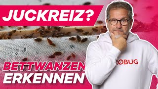 Bettwanzen 👉SO erkennst du sie GARANTIERT [upl. by Beatriz]