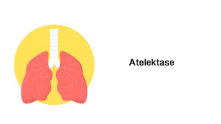 Atelektase  Erkrankungen der Atemwege [upl. by Yonina]