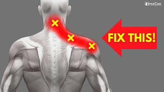 How to INSTANTLY Fix Pinched Nerve Pain in the Neck and Shoulders [upl. by Inattirb]