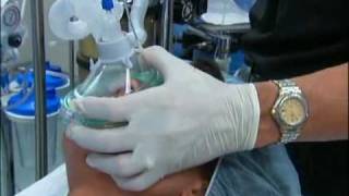 NT About Anesthesia Ch 5  General Anesthesia [upl. by Anovahs994]