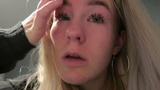 ALLERGISCHE REACTIE😵 DAILY VLOG 148❤️ [upl. by Rizan]