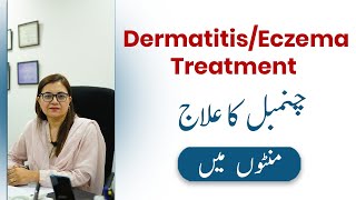 DermatitisEczema Treatment in UrduHindi  Chambal ka ilaj  Prof Dr Nadia Ali Azfar [upl. by Anastas988]