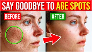 9 Proven BEST Ways To GET RID Of Pesky AGE SPOTS [upl. by Egag132]