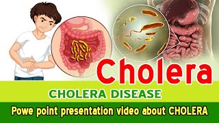 quotCholera Causes Symptoms and Prevention Explainedquot [upl. by Deadman]