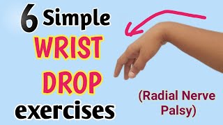 wrist drop exercises in hindi  radial nerve palsy exercises [upl. by Adiarf]