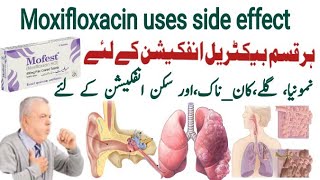 moxifloxacin 400 mg uses in urdu moxifloxacin 400 mg  Mofest 400mg  X gen 400mg  Avelox 400mg [upl. by Rollet]