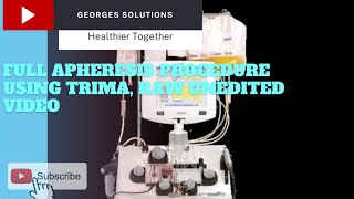 Full apheresis procedure using trima raw unedited video [upl. by Hewitt982]