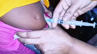 IM Intramuscular Arm injection Push Ketorolac 30 mg Xerokit 24 Ep 106 Anik Health Tips [upl. by Giffie]