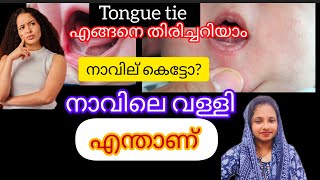 എന്താണ് നാക്കിലെ കെട്ട് നാവിലെ വള്ളി tongue tie എങ്ങനെ തിരിച്ചറിയാം tongue tie malayalam [upl. by Bluma370]