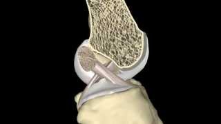 The ACL During Knee Range of Motion [upl. by Cousins]