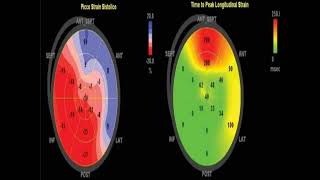 Tissue Doppler and TSE Revolutionizing Medical Diagnostics [upl. by Ray]