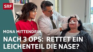 Botox BrustOP und Nasenkorrektur – Wie weit gehen wir für Schönheit  Mona mittendrin 2024  SRF [upl. by Anerda346]