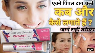 Clinlook t gel  acne pimple gel  पिंपल्स की दवाई  क्लिनलुक जेल  clinlook gel  pimpleproblem [upl. by Champagne534]