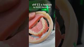 혁신적인 디지털덴쳐틀니 제작 과정 vhf E5 x Ivotion Denture by 박상권 소장 모아치과기공소 [upl. by Susi]