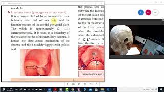 Limiting structures of maxillary arch Part 2 [upl. by Medarda]