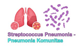 Streptococcus Pneumonia  Pneumonia Komunitas  Definisi Etiologi Patofisiologi Tatalaksana [upl. by Marylinda]