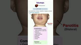 Mumps  Paramyxovirus  Microbiology  Pathology  mbbs  Usmle pharmacology biology neet anatmy [upl. by Ilyak]