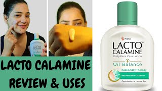 Lacto Calamine Face Lotion Skin Benefitsहिन्दी मैं Calamine lotion Remove Acne Pimples Dark spots [upl. by Jung283]