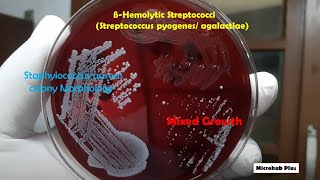 Betahaemolytic colonies of Staphylococcus aureus and Streptococci on Blood agar demonstration [upl. by Htomit69]