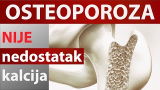 Osteoporoza nije nedostatak kalcijaDr40 [upl. by Savanna]