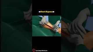 Heart Bypass Surgery Procedure  3D video  cardiology short [upl. by Judenberg]