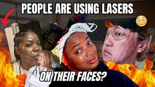 People Are BURNING Their Faces OFF With Laser Facials 🫠 [upl. by Charlotte]