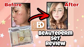 BEAUTEDERM Set Review  Beautederm Before and After  How to use Beautederm Set [upl. by Sully]