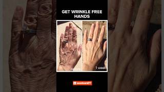 Smooth wrinkle free hands shorts trendingshorts trending fyp viral skincare [upl. by Leckie918]