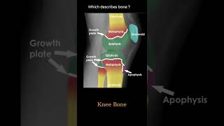 Bone Anatomy knee example 1 Musculoskeletal Xray  General principles radiologychannel007 [upl. by Lemay145]